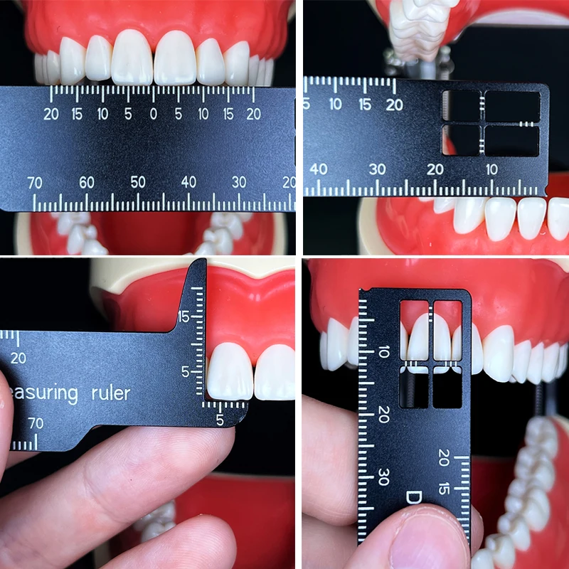 Autoclavable Dental Precision  - Photography Rules review and price