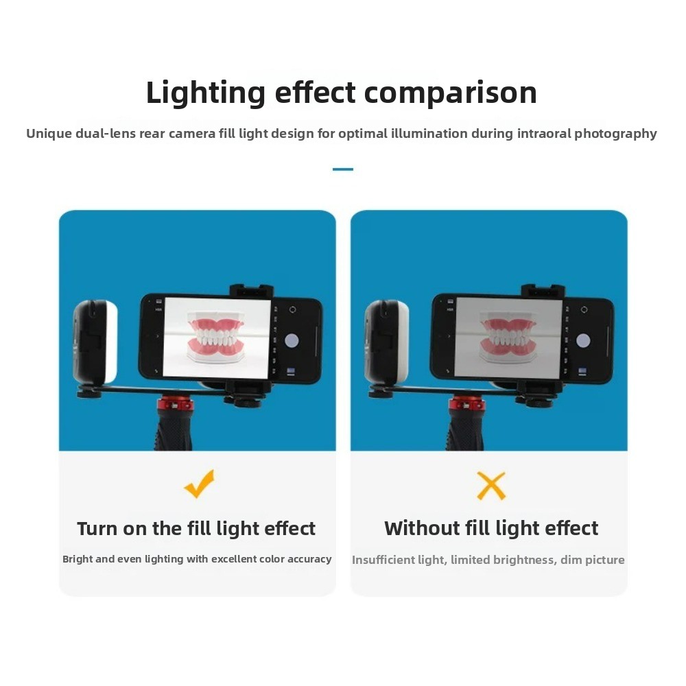 Dental Photography Light, Blue - Photography Basic review and price